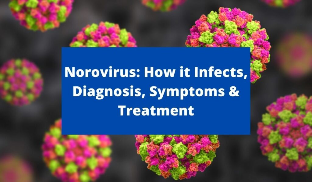 Norovirus 2021: How it Infects Humans? Diagnosis, Symptoms and Treatment